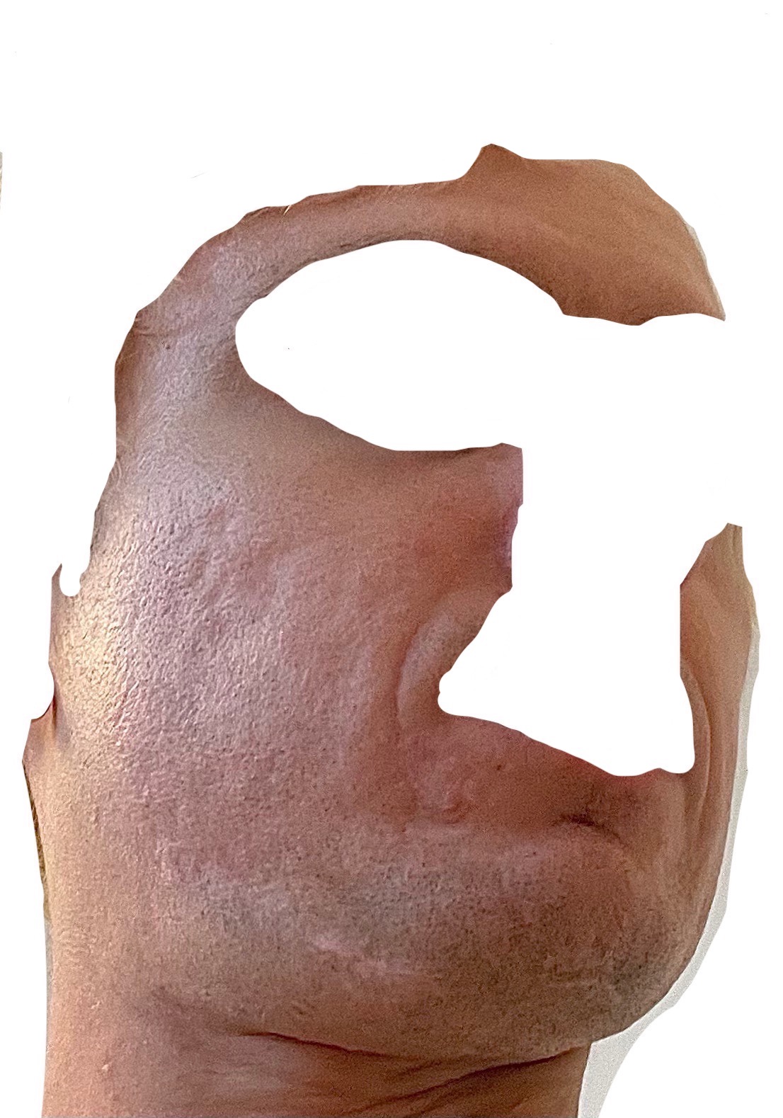 Figure 18