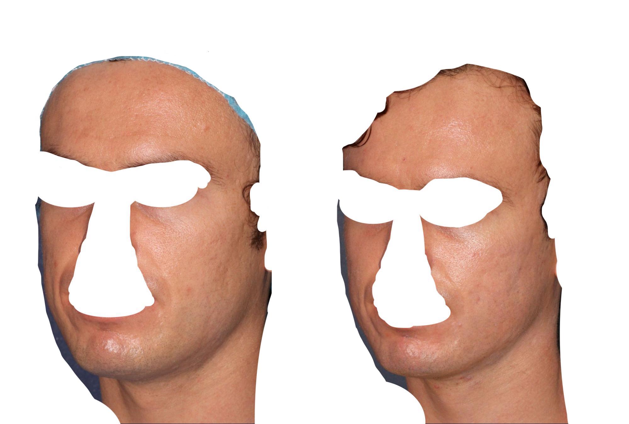 Figure 19