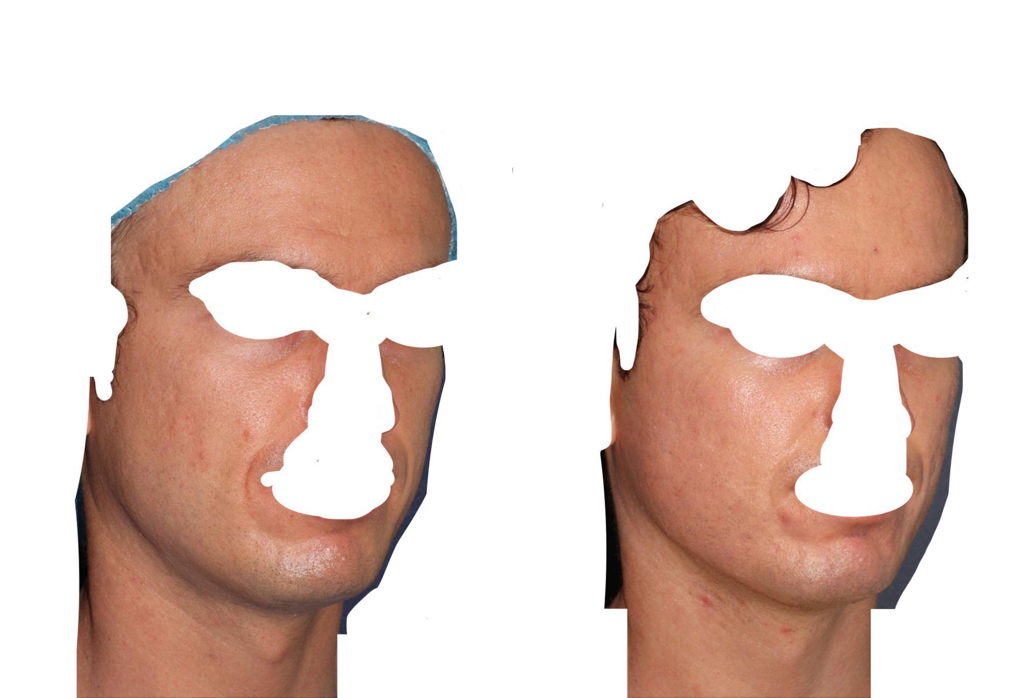 Figure 20