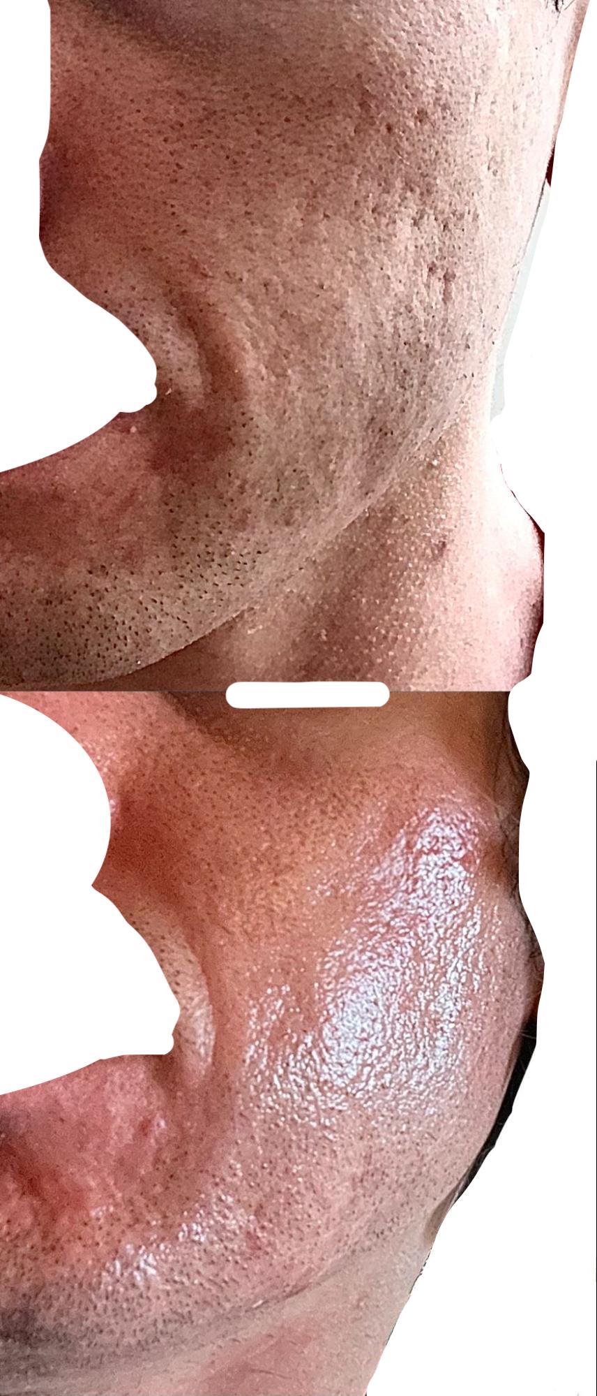 Figure 28