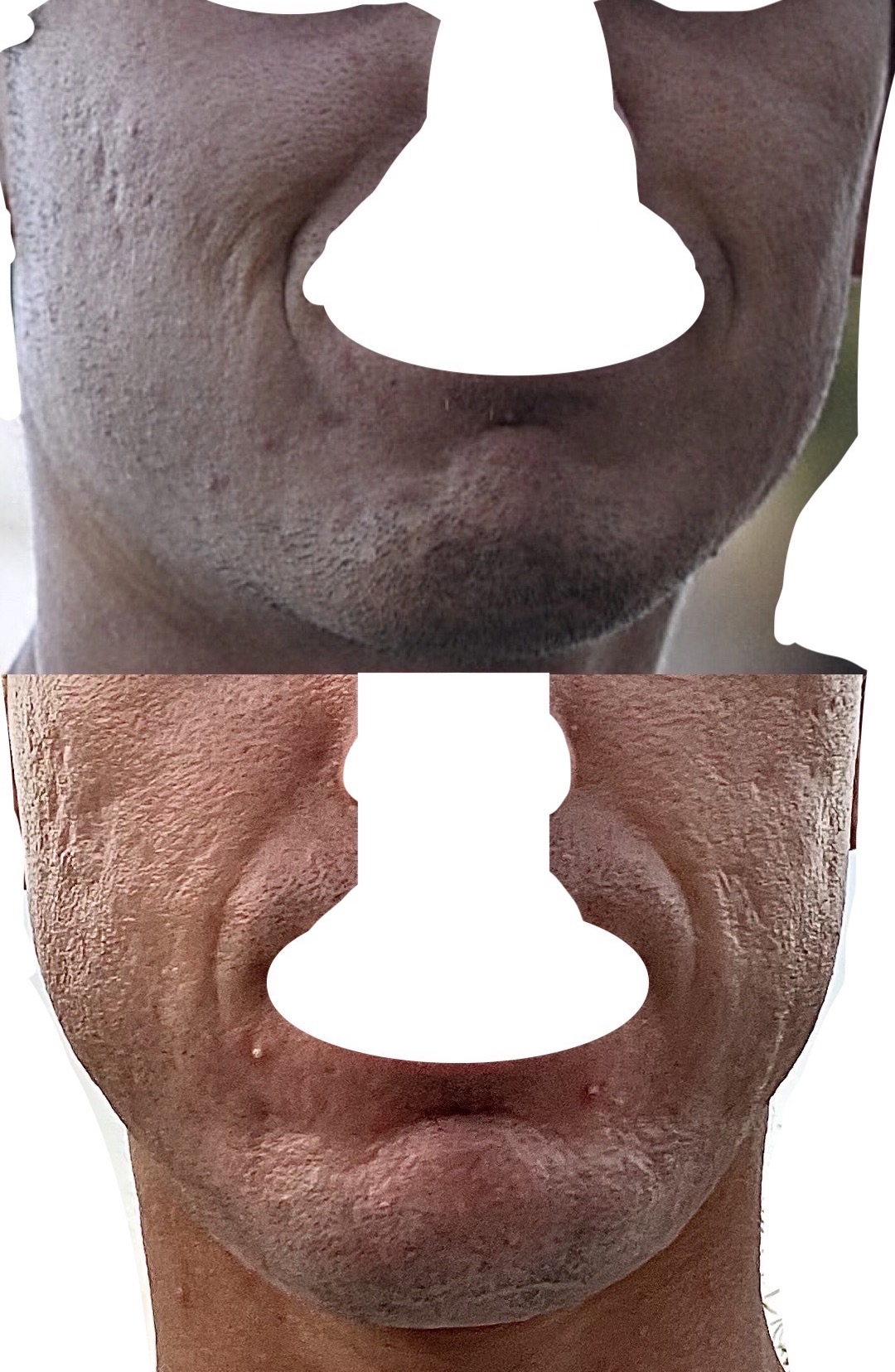 Figure 29