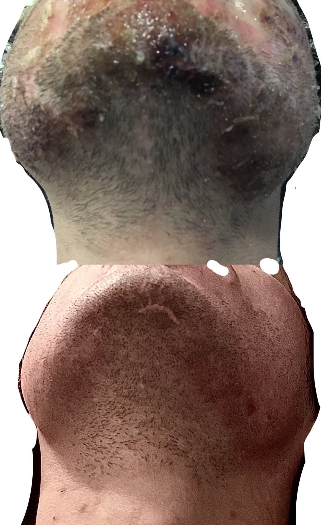 Figure 30