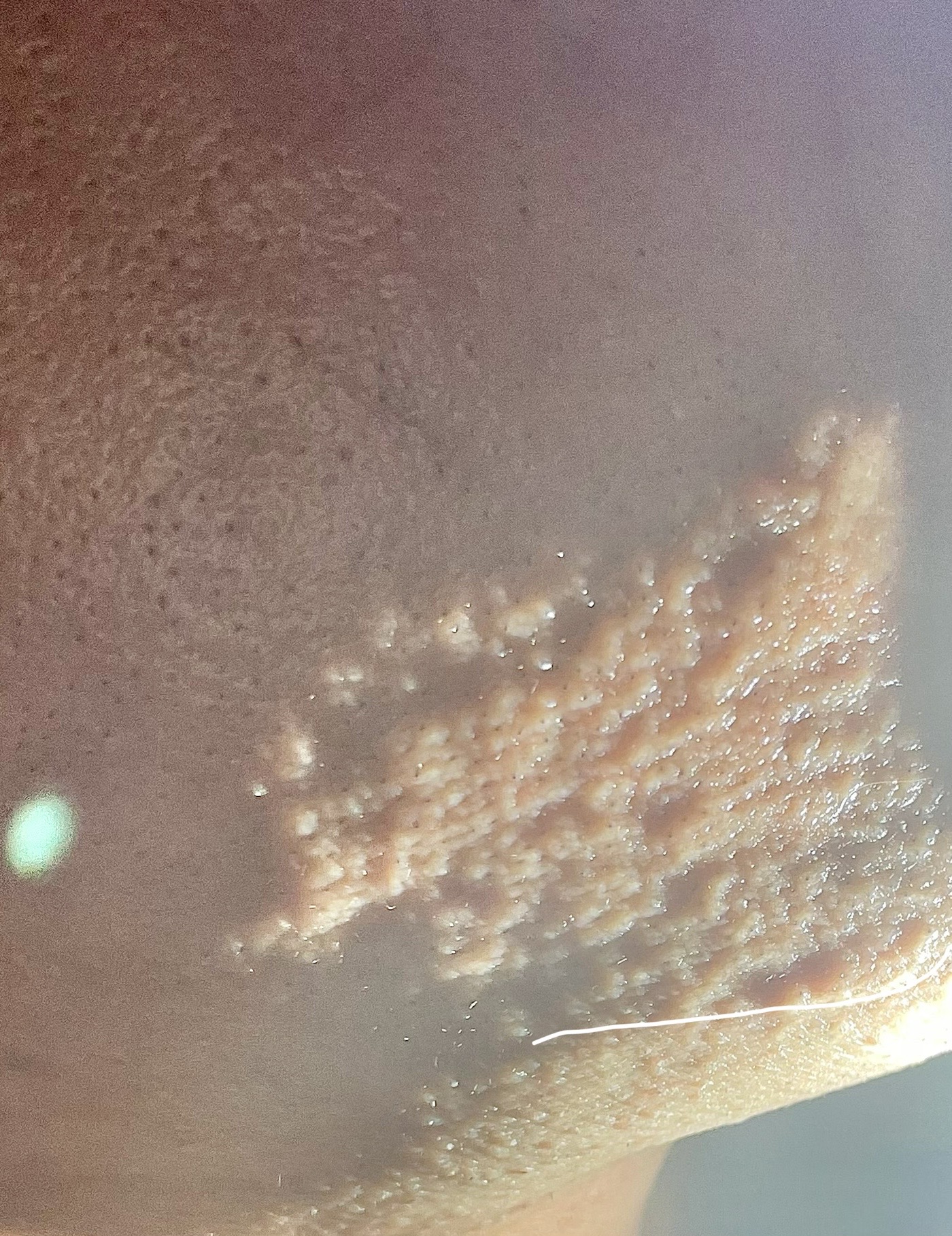 Figure 38